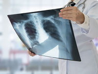 You Should "X-Ray" Your ETF Holdings